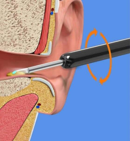 🎉LAST DAY 49% OFF👂Ear Cleaner with 1080P HD Ear Camera